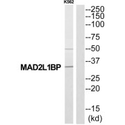 MAD2L1 Binding Protein (MAD2L1BP) Antibody