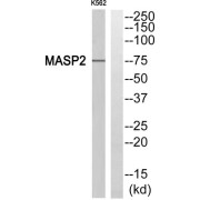 Western blot analysis of extracts from K562 cell, using MASP2 antibody.