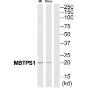 Membrane-Bound Transcription Factor Site-1 Protease (MBTPS1) Antibody