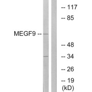 Western blot analysis of extracts from COLO cells, using MEGF9 antibody.