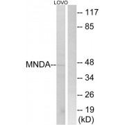 Western blot analysis of extracts from LOVO cells, using MNDA antibody.