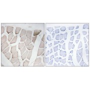 Immunohistochemistry analysis of paraffin-embedded human skeletal muscle tissue using MYOM1 antibody.