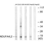 Western blot analysis of extracts from Jurkat cells, COLO cells, HUVEC cells and HepG2 cells, using NDUFA4L2 antibody.