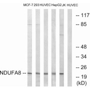 Western blot analysis of extracts from MCF-7 cells, 293 cells, HUVEC cells, HepG2 cells and Jurkat cells, using NDUFA8 antibody.