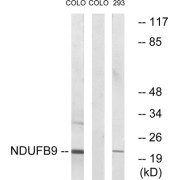 Western blot analysis of extracts from COLO cells and 293 cells, using NDUFB9 antibody.