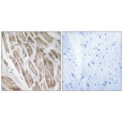 Immunohistochemistry analysis of paraffin-embedded human heart tissue using NDUFS5 antibody.