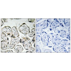 Mitochondrially Encoded NADH:ubiquinone Oxidoreductase Core Subunit 1 (MT-ND1) Antibody