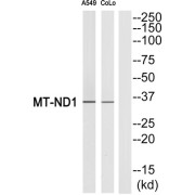 Western blot analysis of extracts from A549 cells and COLO cells, using MT-ND1 antibody.