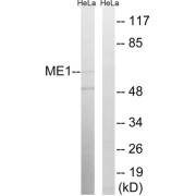 Western blot analysis of extracts from HeLa cells, using ME1 antibody.