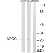 Western blot analysis of extracts from LOVO cells and HepG2 cells, using NPDC1 antibody.