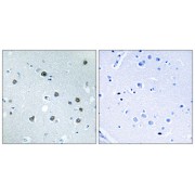 Immunohistochemistry analysis of paraffin-embedded human brain tissue using MYO1D antibody.