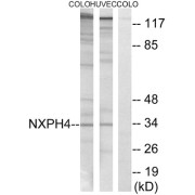 Western blot analysis of extracts from COLO cells and HUVEC cells, using NXPH4 antibody.