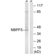 Western blot analysis of extracts from Jurkat cells, using NBPF5 antibody.