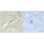 Immunohistochemistry analysis of paraffin-embedded human brain tissue using NSG2 antibody.
