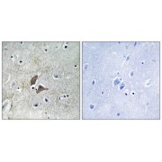 Immunohistochemistry analysis of paraffin-embedded human brain tissue using OMG antibody.