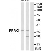 Paired Mesoderm Homeobox Protein 1 (PRRX1) Antibody