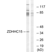 Western blot analysis of extracts from Jurkat cells, using ZDHHC15 antibody.