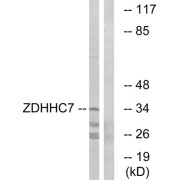 Western blot analysis of extracts from HUVEC cells, using ZDHHC7 antibody.