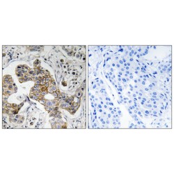 Potassium Two Pore Domain Channel Subfamily K Member 15 (KCNK15) Antibody