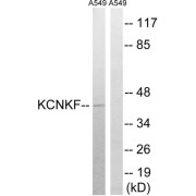 Western blot analysis of extracts from A549 cells, using KCNK15 antibody.