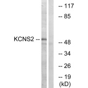 Western blot analysis of extracts from HepG2 cells, using KCNS2 antibody.