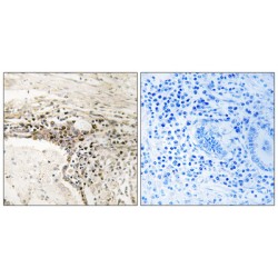 Slingshot Homolog 3 (SSH3) Antibody