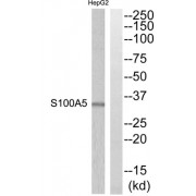Western blot analysis of extracts from HepG2 cells, using S100A5 antibody.