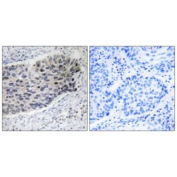 Plasma Anticoagulant Protein C (PC) Antibody