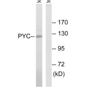 Western blot analysis of extracts from Jurkat cells, using PC antibody.