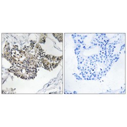 Radical S-Adenosyl Methionine Domain-Containing Protein 1, Mitochondrial (RSAD1) Antibody