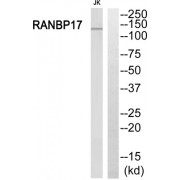 Western blot analysis of extracts from Jurkat cells, using RANBP17 antibody.