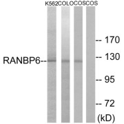 Western blot analysis of extracts from K562 cells, COLO cells and COS-7 cells, using RANBP6 antibody.