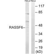 Western blot analysis of extracts from HeLa cells, using RASSF6 antibody.