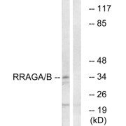 Western blot analysis of extracts from HepG2 cells, using RRAGA/B antibody.