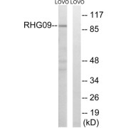 Western blot analysis of extracts from LOVO cells, using RHG9 antibody.