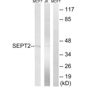 Western blot analysis of extracts from Jurkat cells and MCF-7 cells, using SEPT2 antibody.