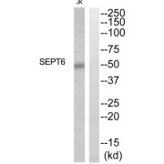 Western blot analysis of extracts from Jurkat cells, using SEPT6 antibody.