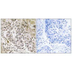 Serine/Threonine Kinase 36 (STK36) Antibody