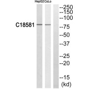 Western blot analysis of extracts from HepG2 cells and COLO205 cells, using NEK5 antibody.