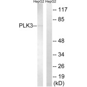 Western blot analysis of extracts from HepG2 cells, using PLK3 antibody.