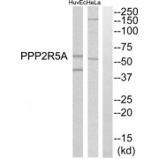 Western blot analysis of extracts from HuvEc cells and HeLa cells, using PPP2R5A antibody.