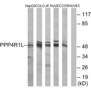 Western blot analysis of extracts from HepG2 cells, COLO cells, Jurkat cells, HUVEC cells and COS cells, using PPP4R1L antibody.