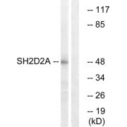 Western blot analysis of extracts from HepG2 cells, using SH2D2A antibody.