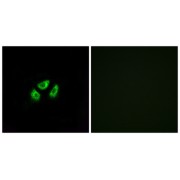 Immunofluorescence analysis of A549 cells, using Sodium Voltage-Gated Channel Alpha Subunit 7 (SCN7A) Antibody. The right image is blocked with SCN7A peptide.