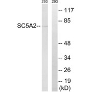 Western blot analysis of extracts from 293 cells, using Sodium/Glucose Cotransporter 2 (SLC5A2) Antibody. The right lane (+) is blocked with recombinant SLC5A2 peptide.