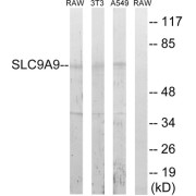 Western blot analysis of extracts from RAW264.7 cells, NIH/3T3 cells and A549 cells, using SLC9A9 antibody.