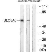 Western blot analysis of extracts from HepG2 cells and HUVEC cells, using SLC5A6 antibody.