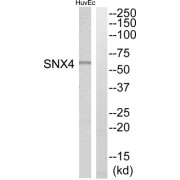 Western blot analysis of extracts from HuvEc cells, using SNX4 antibody.