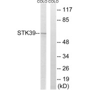 Western blot analysis of extracts from COLO cells, using STK39 antibody.