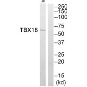 Western blot analysis of extracts from Jurkat cells, using TBX18 antibody.